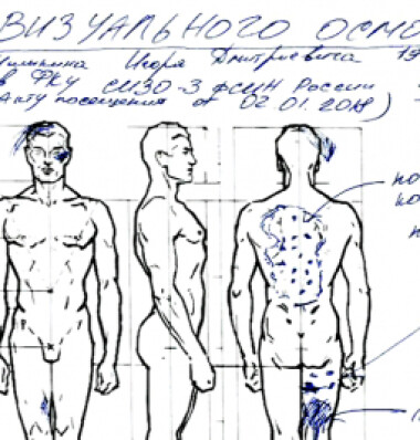 Акт визуального осмотра Игоря Шишкина членами ОНК, обнаружевшего следы пыток